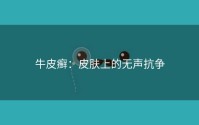 牛皮癣：皮肤上的无声抗争